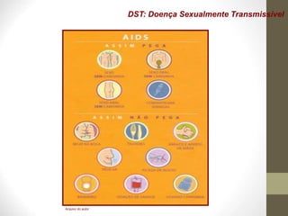 DST: Doença Sexualmente Transmissível
Arquivo do autor
 