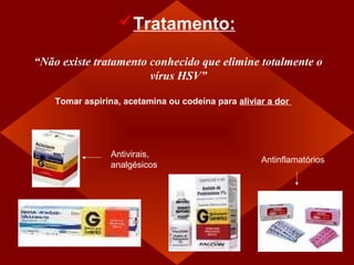 Tratamento:

“Não existe tratamento conhecido que elimine totalmente o
                       vírus HSV”

   • Tomar aspirina, acetamina ou codeína para aliviar a dor




                 Antivirais,
                                                     Antinflamatórios
                 analgésicos
 