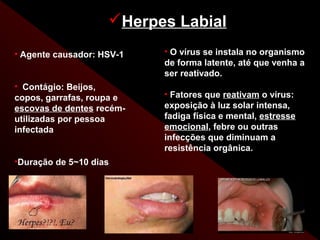 Herpes Labial
• Agente causador: HSV-1   • O vírus se instala no organismo
                           de forma latente, até que venha a
                           ser reativado.
• Contágio: Beijos,
copos, garrafas, roupa e   • Fatores que reativam o vírus:
escovas de dentes recém-   exposição à luz solar intensa,
utilizadas por pessoa      fadiga física e mental, estresse
infectada                  emocional, febre ou outras
                           infecções que diminuam a
                           resistência orgânica.
•Duração de 5~10 dias
 