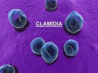 CLAMÍDIA
 