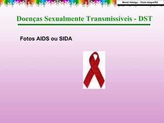 Doenças Sexualmente Transmissíveis - DST  Fotos AIDS ou SIDA Mariel Hidalgo -  Porto Alegre/RS 