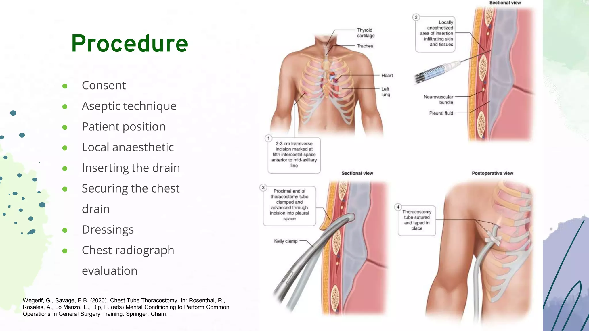 DT Basic Int Pulm.pptx