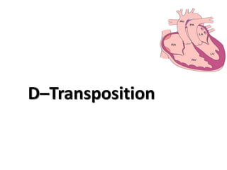 D–Transposition
 