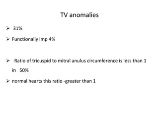 TV anomalies
 31%
 Functionally imp 4%
 Ratio of tricuspid to mitral anulus circumference is less than 1
in 50%
 normal hearts this ratio -greater than 1
 