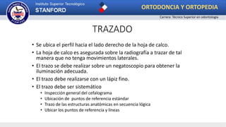 • Se ubica el perfil hacia el lado derecho de la hoja de calco.
• La hoja de calco es asegurada sobre la radiografía a trazar de tal
manera que no tenga movimientos laterales.
• El trazo se debe realizar sobre un negatoscopio para obtener la
iluminación adecuada.
• El trazo debe realizarse con un lápiz fino.
• El trazo debe ser sistemático
• Inspección general del cefalograma
• Ubicación de puntos de referencia estándar
• Trazo de las estructuras anatómicas en secuencia lógica
• Ubicar los puntos de referencia y líneas
TRAZADO
ORTODONCIA Y ORTOPEDIA
Carrera: Técnico Superior en odontología
 