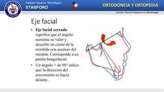 • Eje facial cerrado
significa que el ángulo
aumenta su valor y
describe un cierre de la
mordida con ascenso del
mentón. Corresponde a un
patrón braquifacial.
• Un ángulo > de 90° indica
que la dirección del
crecimiento es hacia
delante.
Eje facial
ORTODONCIA Y ORTOPEDIA
Carrera: Técnico Superior en odontología
 