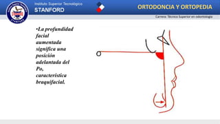 •La profundidad
facial
aumentada
significa una
posición
adelantada del
Po,
característica
braquifacial.
ORTODONCIA Y ORTOPEDIA
Carrera: Técnico Superior en odontología
 