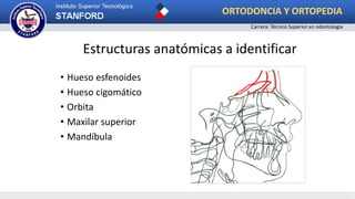 • Hueso esfenoides
• Hueso cigomático
• Orbita
• Maxilar superior
• Mandíbula
Estructuras anatómicas a identificar
ORTODONCIA Y ORTOPEDIA
Carrera: Técnico Superior en odontología
 