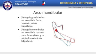 • Un ángulo grande indica
una mandíbula fuerte
cuadrada, patrón
braquifacial.
• Un ángulo menor indica
una mandíbula conrama
corta, forma obtusa y un
patrón de crecimiento
dolicofacial.
Arco mandibular
ORTODONCIA Y ORTOPEDIA
Carrera: Técnico Superior en odontología
 
