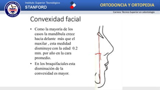 • Como la mayoría de los
casos la mandíbula crece
hacia delante más que el
maxilar , esta medidad
disminuye con la edad 0.2
mm. por año en la cara
promedio.
• En los braquifaciales esta
disminución de la
convexidad es mayor.
Convexidad facial
ORTODONCIA Y ORTOPEDIA
Carrera: Técnico Superior en odontología
 