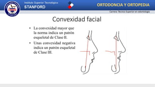 • La convexidad mayor que
la norma indica un patrón
esqueletal de Clase II.
• Unas convexidad negativa
indica un patrón esqueletal
de Clase III.
Convexidad facial
ORTODONCIA Y ORTOPEDIA
Carrera: Técnico Superior en odontología
 