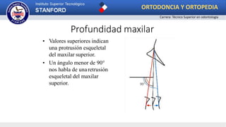 • Valores superiores indican
una protrusión esqueletal
del maxilar superior.
• Un ángulo menor de 90°
nos habla de unaretrusión
esqueletal del maxilar
superior.
Profundidad maxilar
ORTODONCIA Y ORTOPEDIA
Carrera: Técnico Superior en odontología
 