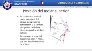 Posición del molar superior
• Es la distancia entre el
punto más distal del
primer molar superior
permanente y la vertical
pterigoidea medida en
dirección paralela al plano
oclusal.
• La norma es la edad del
paciente en años + 3mm.,
con una desviaciónclínica
de ± 3mm.
ORTODONCIA Y ORTOPEDIA
Carrera: Técnico Superior en odontología
 