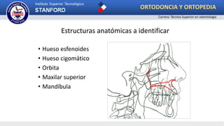 • Hueso esfenoides
• Hueso cigomático
• Orbita
• Maxilar superior
• Mandíbula
Estructuras anatómicas a identificar
ORTODONCIA Y ORTOPEDIA
Carrera: Técnico Superior en odontología
 