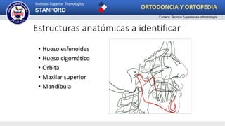• Hueso esfenoides
• Hueso cigomático
• Orbita
• Maxilar superior
• Mandíbula
Estructuras anatómicas a identificar
ORTODONCIA Y ORTOPEDIA
Carrera: Técnico Superior en odontología
 