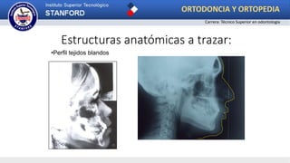 •Perfil tejidos blandos
Estructuras anatómicas a trazar:
ORTODONCIA Y ORTOPEDIA
Carrera: Técnico Superior en odontología
 