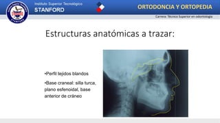 •Perfil tejidos blandos
•Base craneal: silla turca,
plano esfenoidal, base
anterior de cráneo
Estructuras anatómicas a trazar:
ORTODONCIA Y ORTOPEDIA
Carrera: Técnico Superior en odontología
 
