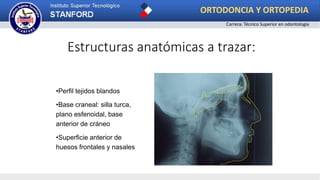 •Perfil tejidos blandos
•Base craneal: silla turca,
plano esfenoidal, base
anterior de cráneo
•Superficie anterior de
huesos frontales y nasales
Estructuras anatómicas a trazar:
ORTODONCIA Y ORTOPEDIA
Carrera: Técnico Superior en odontología
 