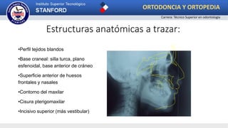 •Perfil tejidos blandos
•Base craneal: silla turca, plano
esfenoidal, base anterior de cráneo
•Superficie anterior de huesos
frontales y nasales
•Contorno del maxilar
•Cisura pterigomaxilar
•Incisivo superior (más vestibular)
Estructuras anatómicas a trazar:
ORTODONCIA Y ORTOPEDIA
Carrera: Técnico Superior en odontología
 