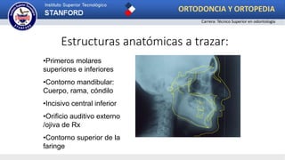 •Primeros molares
superiores e inferiores
•Contorno mandibular:
Cuerpo, rama, cóndilo
•Incisivo central inferior
•Orificio auditivo externo
/ojiva de Rx
•Contorno superior de la
faringe
Estructuras anatómicas a trazar:
ORTODONCIA Y ORTOPEDIA
Carrera: Técnico Superior en odontología
 