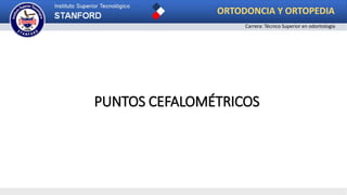 PUNTOS CEFALOMÉTRICOS
ORTODONCIA Y ORTOPEDIA
Carrera: Técnico Superior en odontología
 