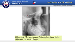 Silla o sela (S): centro geométrico del contorno de la
silla turca o fosa hipofisiaria.
ORTODONCIA Y ORTOPEDIA
Carrera: Técnico Superior en odontología
 