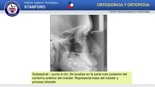 .
Subespinal – punto A (A): Se localiza en la parte más posterior del
contorno anterior del maxilar. Representa base del maxilar y
proceso alveolar
ORTODONCIA Y ORTOPEDIA
Carrera: Técnico Superior en odontología
 