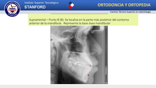 Supramental – Punto B (B): Se localiza en la parte más posterior del contorno
anterior de la mandíbula. Representa la base ósea mandibular
ORTODONCIA Y ORTOPEDIA
Carrera: Técnico Superior en odontología
 