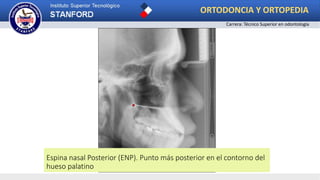Espina nasal Posterior (ENP). Punto más posterior en el contorno del
hueso palatino
ORTODONCIA Y ORTOPEDIA
Carrera: Técnico Superior en odontología
 