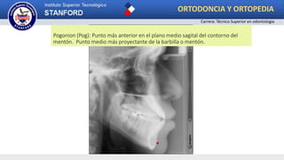 Pogonion (Pog): Punto más anterior en el plano medio sagital del contorno del
mentón. Punto medio más proyectante de la barbilla o mentón.
ORTODONCIA Y ORTOPEDIA
Carrera: Técnico Superior en odontología
 
