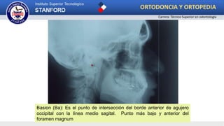 .
Basion (Ba): Es el punto de intersección del borde anterior de agujero
occipital con la línea medio sagital. Punto más bajo y anterior del
foramen magnum
ORTODONCIA Y ORTOPEDIA
Carrera: Técnico Superior en odontología
 