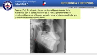 .
Gonion (Go). Es el punto de encuentro del borde inferior de la
mandíbula con el borde posterior de la rama, generalmente se
construye bisecando el ángulo formado entre el plano mandibular y el
plano de las ramas mandibulares
ORTODONCIA Y ORTOPEDIA
Carrera: Técnico Superior en odontología
 