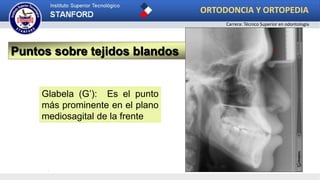 .
Puntos sobre tejidos blandos
Glabela (G’): Es el punto
más prominente en el plano
mediosagital de la frente
ORTODONCIA Y ORTOPEDIA
Carrera: Técnico Superior en odontología
 