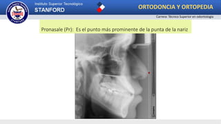 Pronasale (Pr): Es el punto más prominente de la punta de la nariz
ORTODONCIA Y ORTOPEDIA
Carrera: Técnico Superior en odontología
 