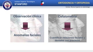 Observación clínica
Anomalías faciales
Cefalometría
Cuantificar relaciones faciales y
dentales con precisión
ORTODONCIA Y ORTOPEDIA
Carrera: Técnico Superior en odontología
 