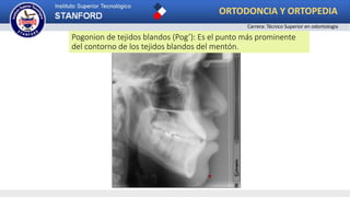 Pogonion de tejidos blandos (Pog’): Es el punto más prominente
del contorno de los tejidos blandos del mentón.
ORTODONCIA Y ORTOPEDIA
Carrera: Técnico Superior en odontología
 