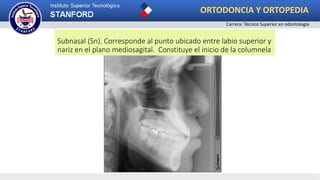 Subnasal (Sn). Corresponde al punto ubicado entre labio superior y
nariz en el plano mediosagital. Constituye el inicio de la columnela
ORTODONCIA Y ORTOPEDIA
Carrera: Técnico Superior en odontología
 