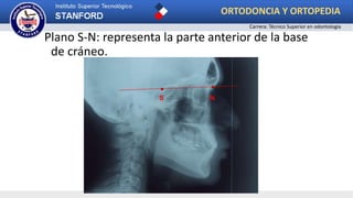 Plano S-N: representa la parte anterior de la base
de cráneo.
NS
ORTODONCIA Y ORTOPEDIA
Carrera: Técnico Superior en odontología
 