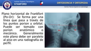 Plano horizontal de Frankfort
(Po-Or): Se forma por una
línea que pasa a través de
los puntos porion y orbital.
Puede ser tomado con
porion anatómico o
mecánico. Generalmente
este plano debe ser paralelo
al piso en una radiografía de
perfil.
OrPo
ORTODONCIA Y ORTOPEDIA
Carrera: Técnico Superior en odontología
 