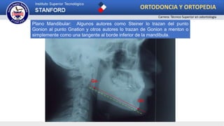 Plano S-N
Gn
Go
Plano Mandibular: Algunos autores como Steiner lo trazan del punto
Gonion al punto Gnation y otros autores lo trazan de Gonion a menton o
simplemente como una tangente al borde inferior de la mandíbula.
ORTODONCIA Y ORTOPEDIA
Carrera: Técnico Superior en odontología
 