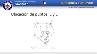 Ubicación de puntos E y L
ORTODONCIA Y ORTOPEDIA
Carrera: Técnico Superior en odontología
 