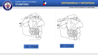 SL = 51mm SE = 22 mm
ORTODONCIA Y ORTOPEDIA
Carrera: Técnico Superior en odontología
 