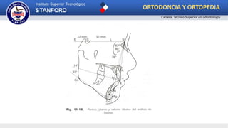 ORTODONCIA Y ORTOPEDIA
Carrera: Técnico Superior en odontología
 