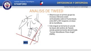 ANALISIS DE TWEED
• Observa que en primer grupo los
incisivos inferiores están
verticalizados sobre el hueso basal,
entre 85º y 95º respecto a la base
de la mandíbula.
• Este ángulo se tornaría en una de
las bases del análisis de Tweed,
siendo posteriormente denominado
“Incisor Mandibular Plane Angle”
(IMPA).
IMPA
ORTODONCIA Y ORTOPEDIA
Carrera: Técnico Superior en odontología
 