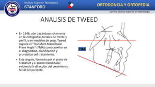 ANALISIS DE TWEED
• En 1946, aún basándose solamente
en las fotografías faciales de frente y
perfil, y en modelos de yeso. Tweed
sugiere el “Frankfurt-Mandibular
Plane Angle” (FMA) como auxiliar en
el diagnóstico, planificación y
pronóstico del tratamiento.
• Este ángulo, formado por el plano de
Frankfurt y el plano mandibular,
evidencia la dirección del crecimiento
facial del paciente.
FMA
ORTODONCIA Y ORTOPEDIA
Carrera: Técnico Superior en odontología
 