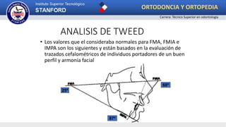 ANALISIS DE TWEED
• Los valores que el consideraba normales para FMA, FMIA e
IMPA son los siguientes y están basados en la evaluación de
trazados cefalométricos de individuos portadores de un buen
perfil y armonía facial
25º
87º
68º
ORTODONCIA Y ORTOPEDIA
Carrera: Técnico Superior en odontología
 