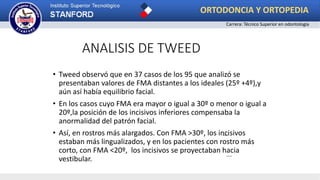 ANALISIS DE TWEED
• Tweed observó que en 37 casos de los 95 que analizó se
presentaban valores de FMA distantes a los ideales (25º +4º),y
aún así había equilibrio facial.
• En los casos cuyo FMA era mayor o igual a 30º o menor o igual a
20º,la posición de los incisivos inferiores compensaba la
anormalidad del patrón facial.
• Así, en rostros más alargados. Con FMA >30º, los incisivos
estaban más lingualizados, y en los pacientes con rostro más
corto, con FMA <20º, los incisivos se proyectaban hacia
vestibular.
ORTODONCIA Y ORTOPEDIA
Carrera: Técnico Superior en odontología
 