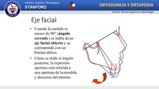 • Cuando la medida es
menor de 90° (ángulo
cerrado ) se habla deun
eje facial abierto y se
corresponde con un
biotipo dólico.
• Cómo se mide el ángulo
posterior, la expresión
apertura está referida a
una apertura de lamordida
y descenso del mentón.
Eje facial
ORTODONCIA Y ORTOPEDIA
Carrera: Técnico Superior en odontología
 