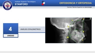 UNIDAD
4 ANÁLISIS CEFALOMETRICO
ORTODONCIA Y ORTOPEDIA
Carrera: Técnico Superior en odontología
 