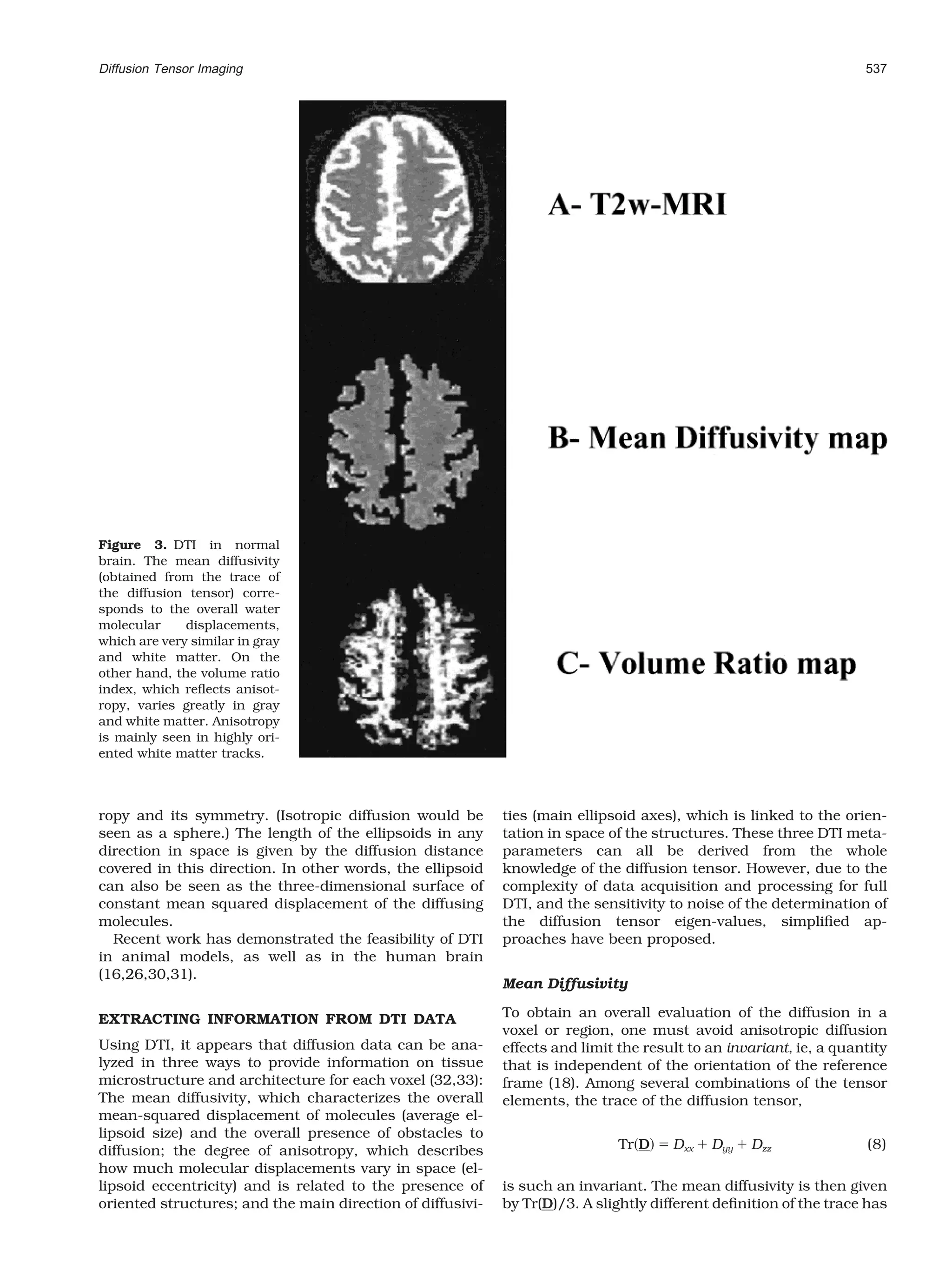 Diffusion Tensor Imaging                                                                                            537




Figure 3. DTI in normal
brain. The mean diffusivity
(obtained from the trace of
the diffusion tensor) corre-
sponds to the overall water
molecular     displacements,
which are very similar in gray
and white matter. On the
other hand, the volume ratio
index, which reﬂects anisot-
ropy, varies greatly in gray
and white matter. Anisotropy
is mainly seen in highly ori-
ented white matter tracks.



ropy and its symmetry. (Isotropic diffusion would be        ties (main ellipsoid axes), which is linked to the orien-
seen as a sphere.) The length of the ellipsoids in any      tation in space of the structures. These three DTI meta-
direction in space is given by the diffusion distance       parameters can all be derived from the whole
covered in this direction. In other words, the ellipsoid    knowledge of the diffusion tensor. However, due to the
can also be seen as the three-dimensional surface of        complexity of data acquisition and processing for full
constant mean squared displacement of the diffusing         DTI, and the sensitivity to noise of the determination of
molecules.                                                  the diffusion tensor eigen-values, simpliﬁed ap-
  Recent work has demonstrated the feasibility of DTI       proaches have been proposed.
in animal models, as well as in the human brain
(16,26,30,31).
                                                            Mean Diffusivity

EXTRACTING INFORMATION FROM DTI DATA                        To obtain an overall evaluation of the diffusion in a
                                                            voxel or region, one must avoid anisotropic diffusion
Using DTI, it appears that diffusion data can be ana-       effects and limit the result to an invariant, ie, a quantity
lyzed in three ways to provide information on tissue        that is independent of the orientation of the reference
microstructure and architecture for each voxel (32,33):     frame (18). Among several combinations of the tensor
The mean diffusivity, which characterizes the overall       elements, the trace of the diffusion tensor,
mean-squared displacement of molecules (average el-
lipsoid size) and the overall presence of obstacles to
diffusion; the degree of anisotropy, which describes                          Tr D    Dxx   Dyy   Dzz               (8)
how much molecular displacements vary in space (el-
lipsoid eccentricity) and is related to the presence of     is such an invariant. The mean diffusivity is then given
oriented structures; and the main direction of diffusivi-   by Tr(D)/3. A slightly different deﬁnition of the trace has
 